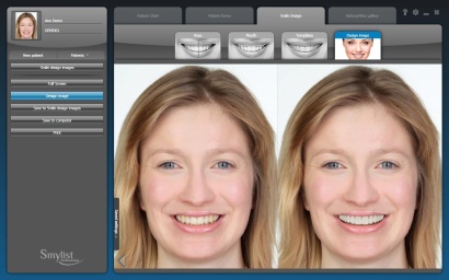 Smylist szoftver mosolytervezés közben